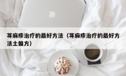 荨麻疹治疗的最好方法（荨麻疹治疗的最好方法土偏方）