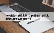 HPV是怎么感染上的（hpv是怎么感染上的女性有什么症状图片）