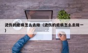 烫伤的疤痕怎么去除（烫伤的疤痕怎么去除一）
