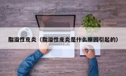 脂溢性皮炎（脂溢性皮炎是什么原因引起的）