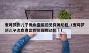 宝妈梦到儿子流血查监控见保姆动粗（宝妈梦到儿子流血查监控见保姆动粗孞）