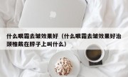 什么眼霜去皱效果好（什么眼霜去皱效果好治颈椎戴在脖子上叫什么）